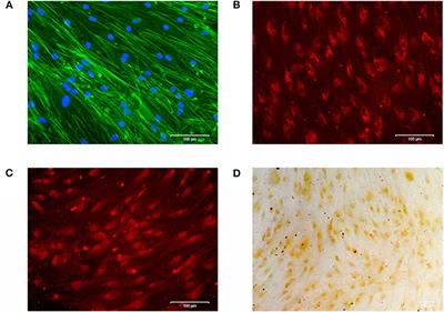 Autophagy Induces Expression of IL-6 in Human Periodontal Ligament Fibroblasts Under Mechanical Load and Overload and Effects Osteoclastogenesis in vitro